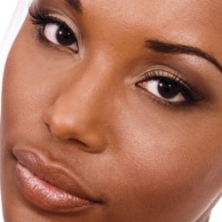 Understanding Vitiligo and Its Treatment